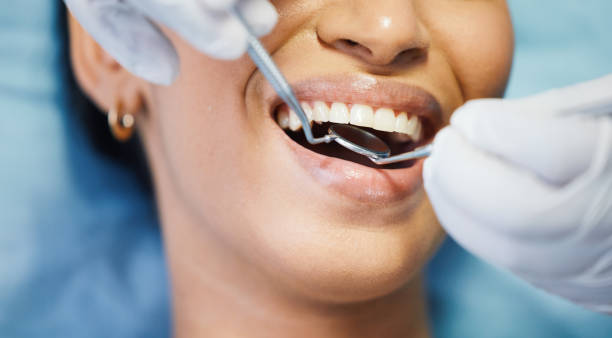 Best Urgent Tooth Repair  in Cottage Grove, OR